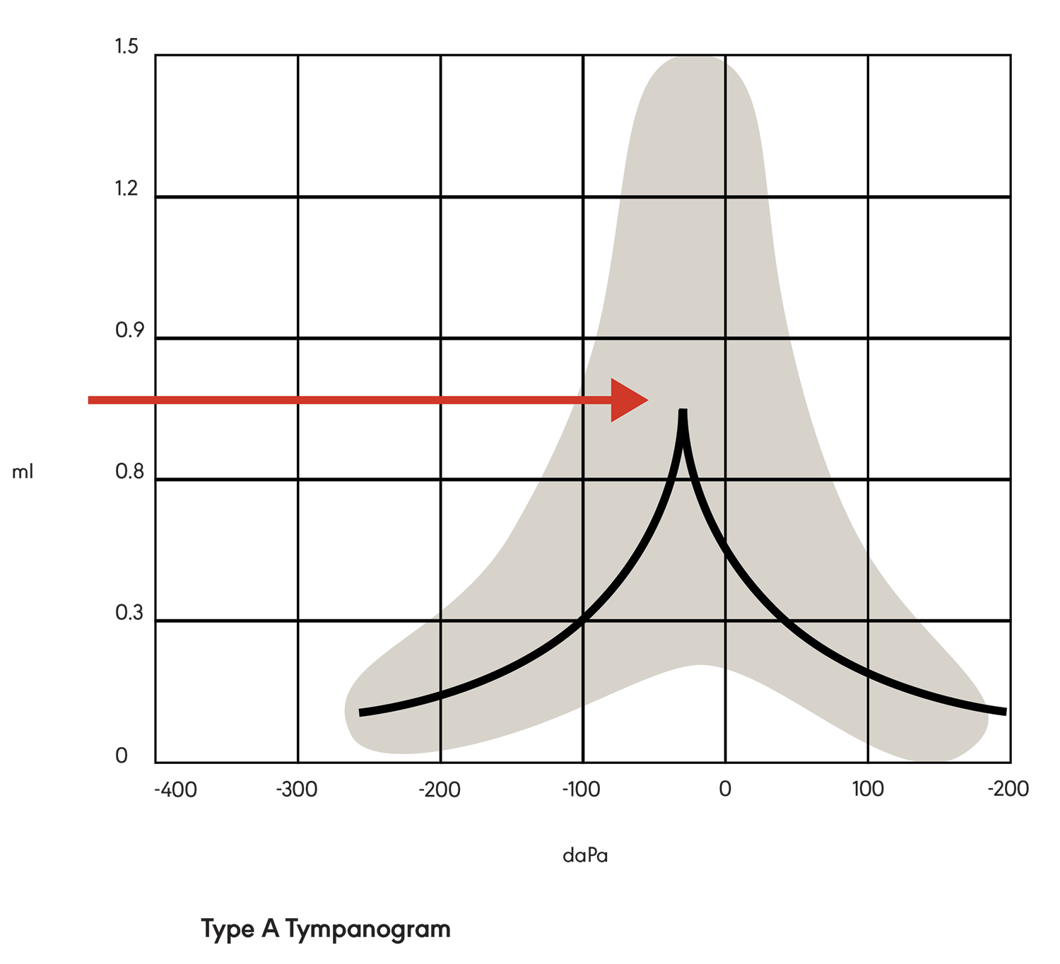 Figure 1. Type A tympanogram