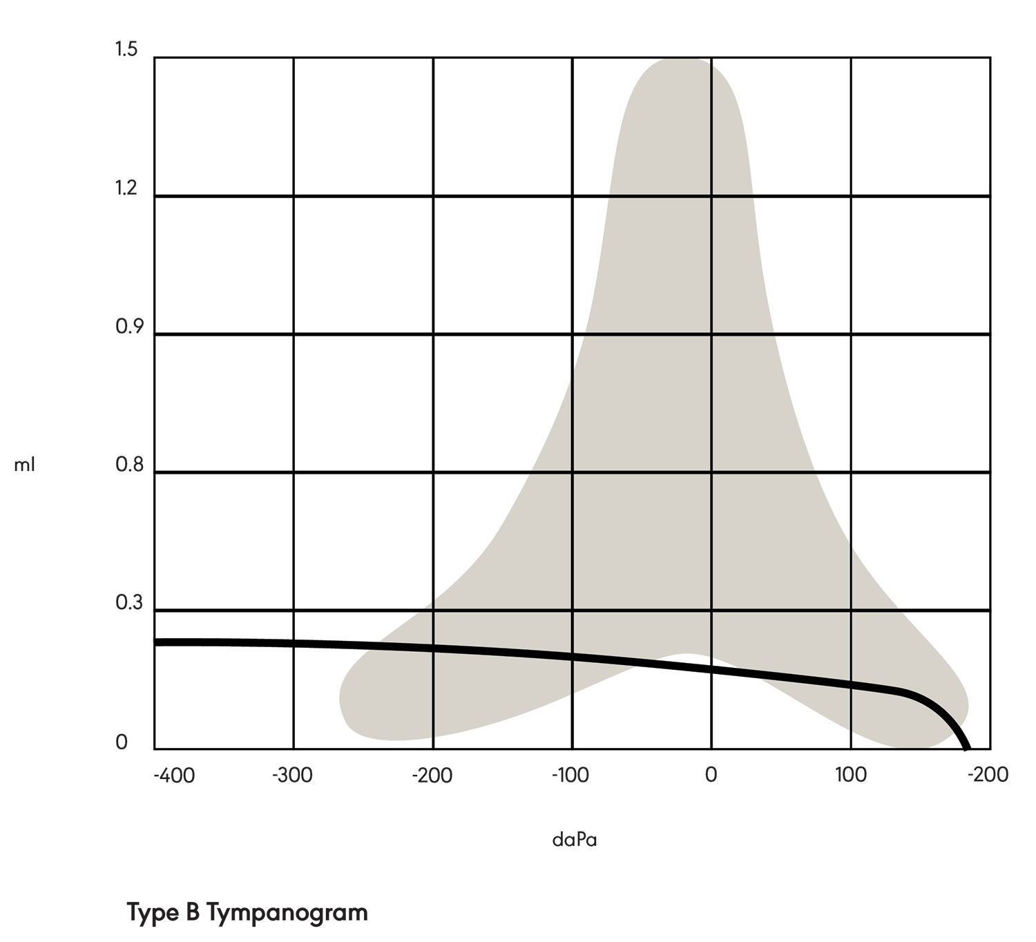 Figure 2. Type B tympanogram