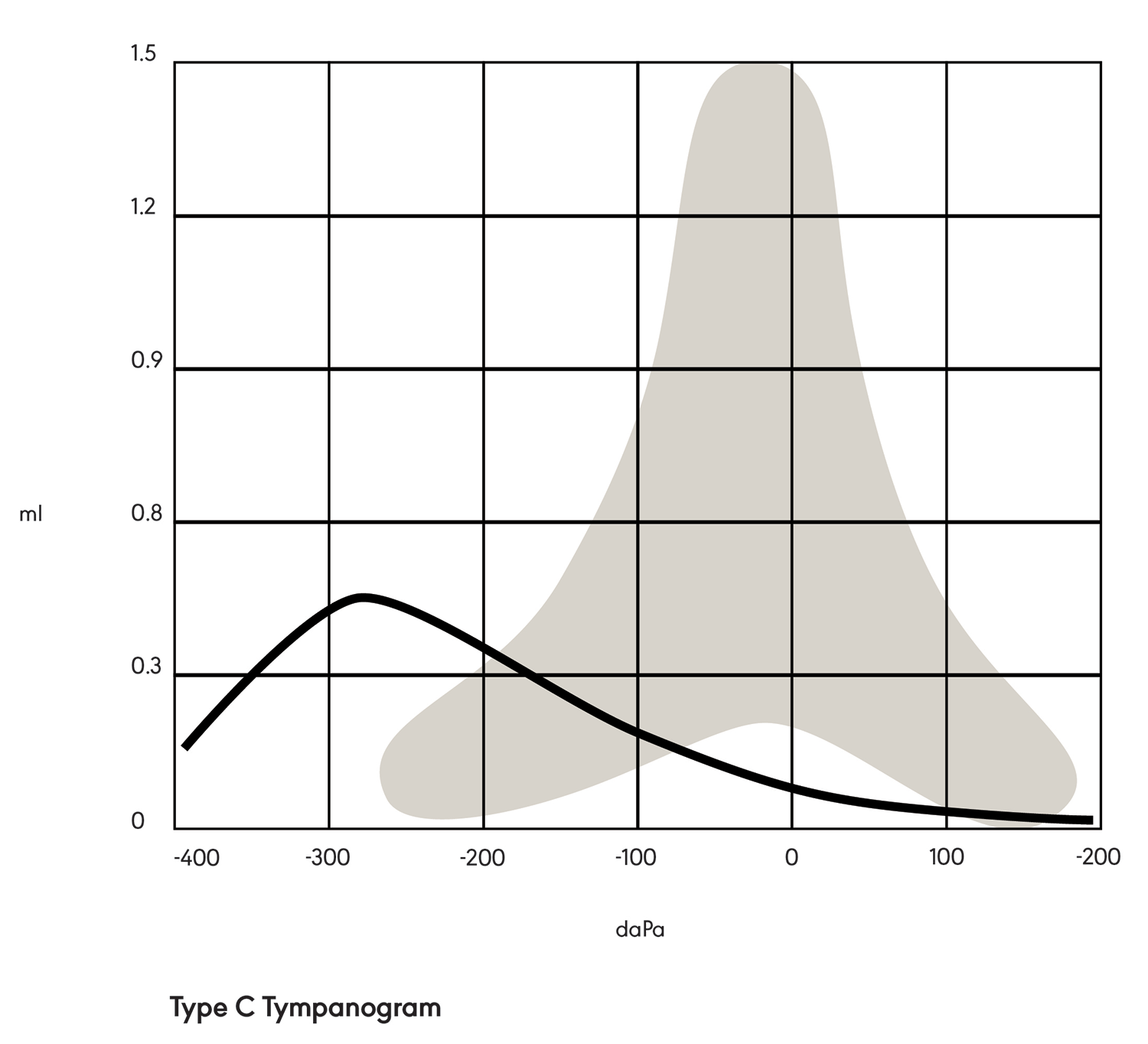 Figure 3. Type C tympanogram